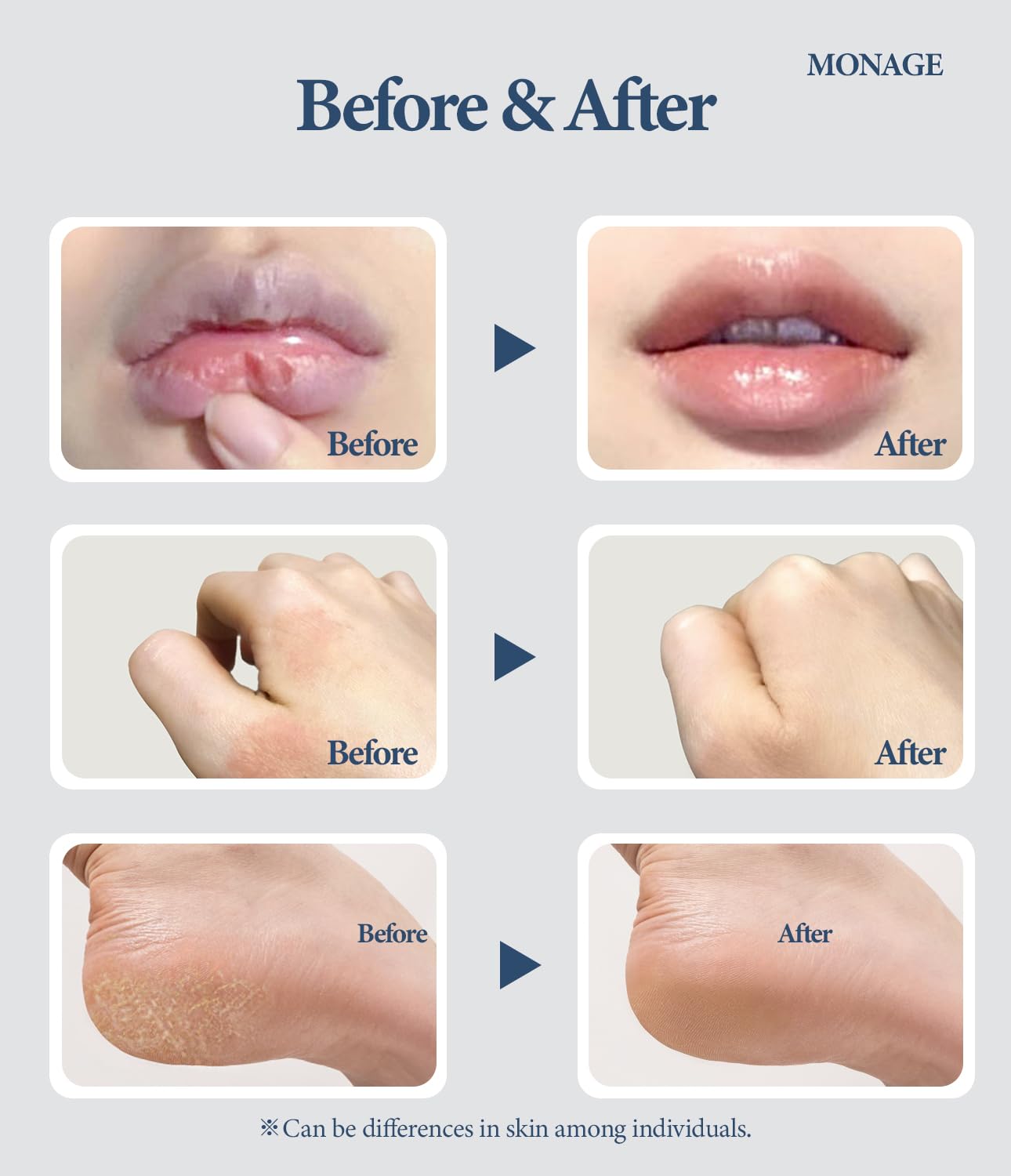 Korea Vegan & Nourishing & Moisturizing Lip Care Made from 100% Natural Ingredients, Organic Moisturizer for Dry, Cracked Lips & Skin, Long-lasting Lip Balm, Comfort, 0.38 Ounce