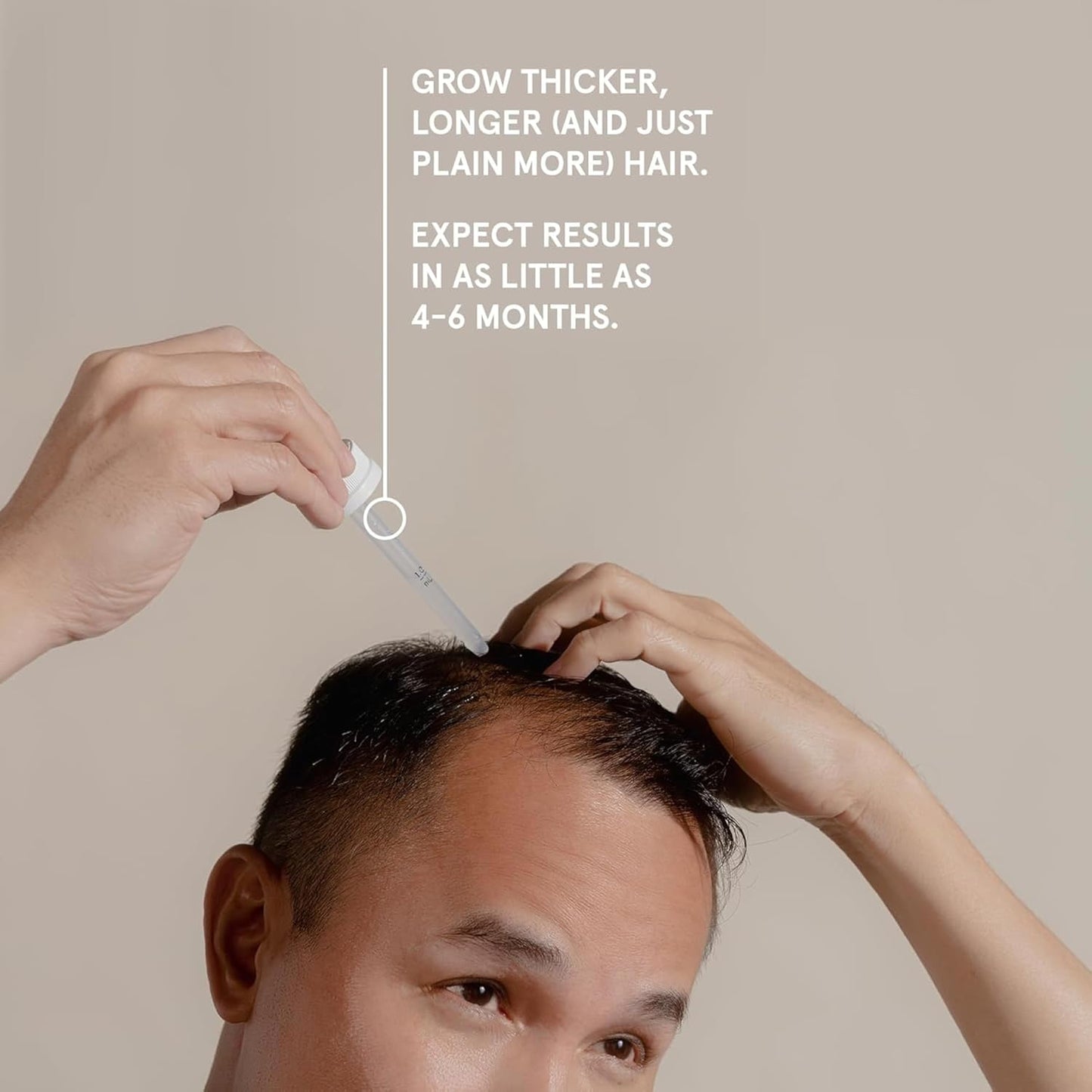 Keeps Extra Strength Minoxidil for Men Topical Hair Growth Serum, 5% Solution Hair Loss Treatment - 3 Month Supply (3 x 2oz Bottles with Dropper) - Slows Hair Loss & Promotes Thicker Hair Regrowth