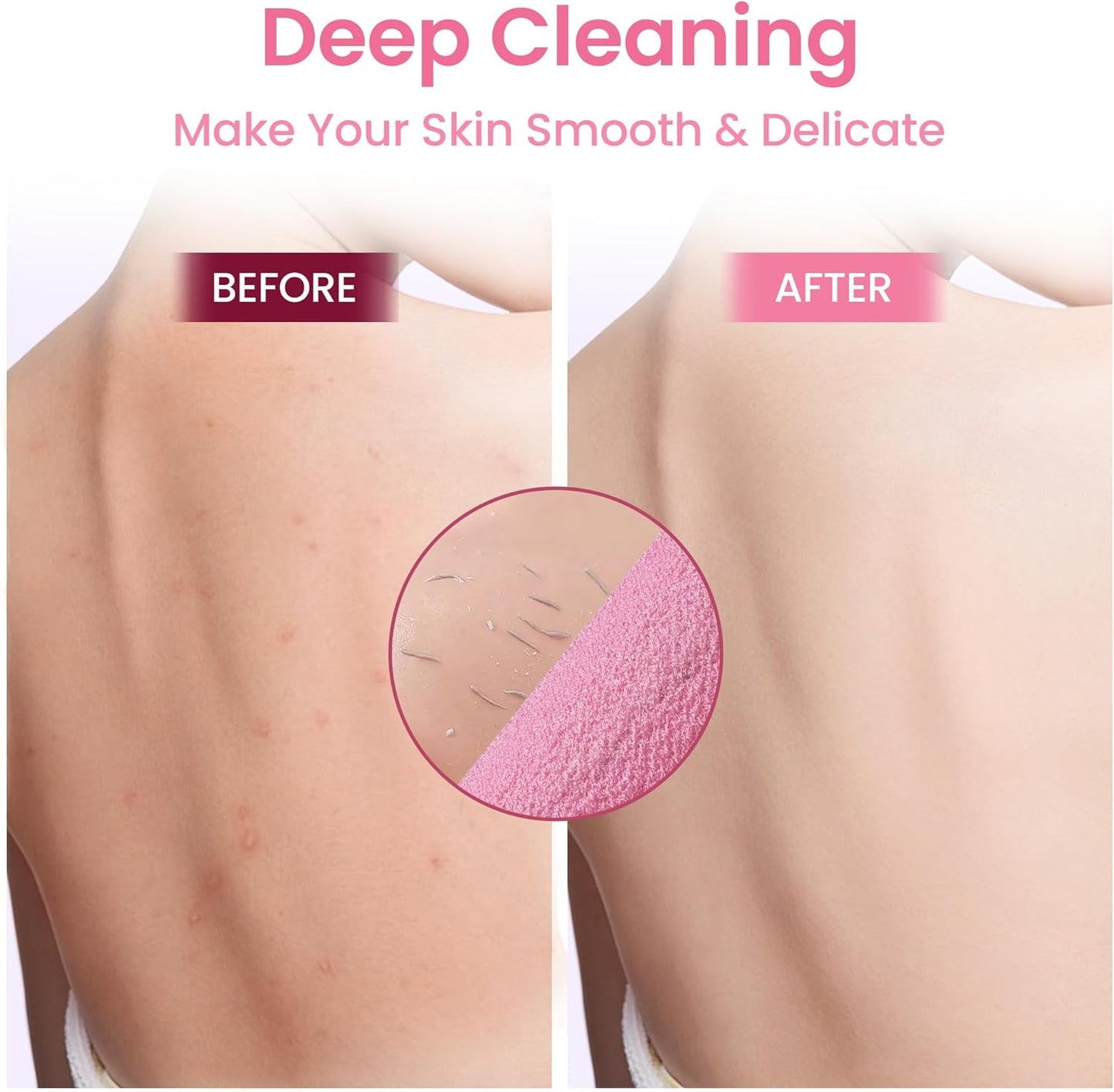 3 Pcs Double-Sided Back Exfoliator Body Scrub Towel, Exfoliating Back Scrubber with Handles,Exfoliating Washcloth Bath Tool in Shower, Stretchable Back Washer to Deep Cleans Skin (Pink)