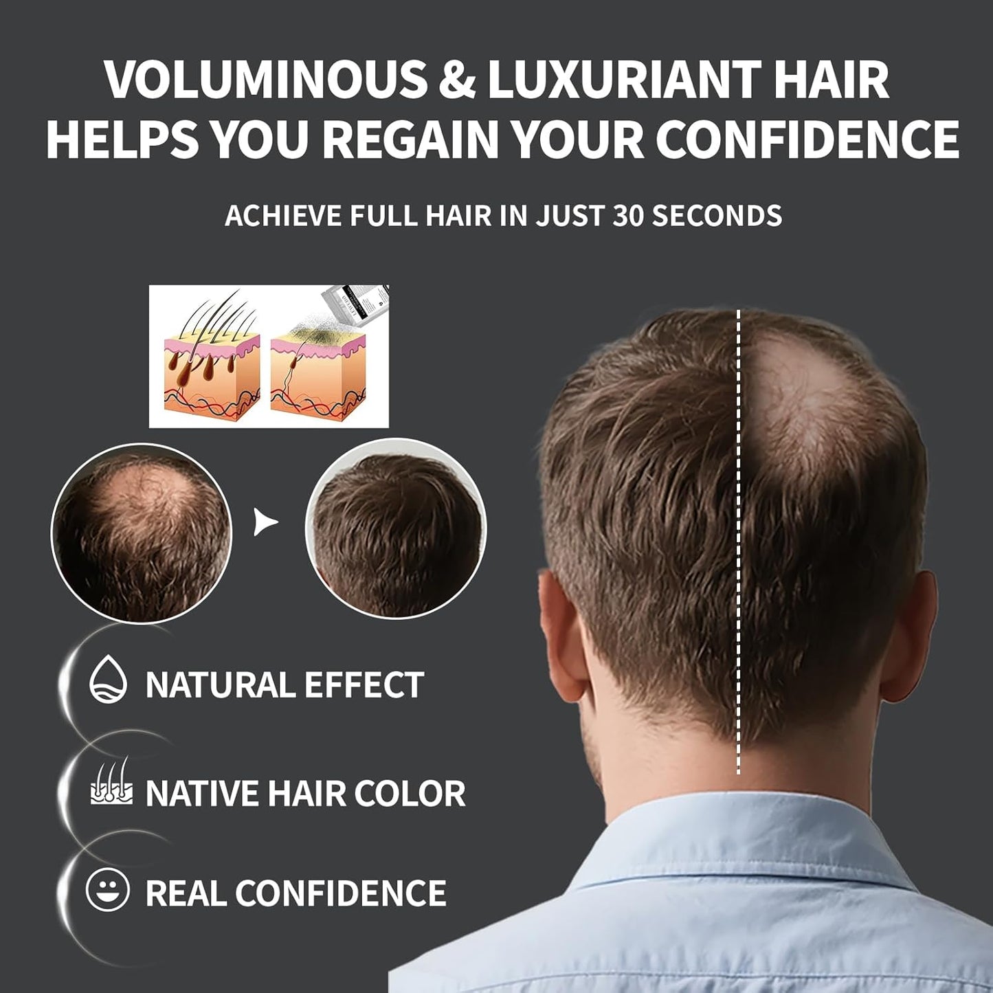 Hair Building Fibers Refill Pack - 100g Instant Thickening Fibers for Men & Women, Natural Cotton Powder, Wind/Rain Resistant, For All Hair Fiber Applicator Bottles (Light brown)