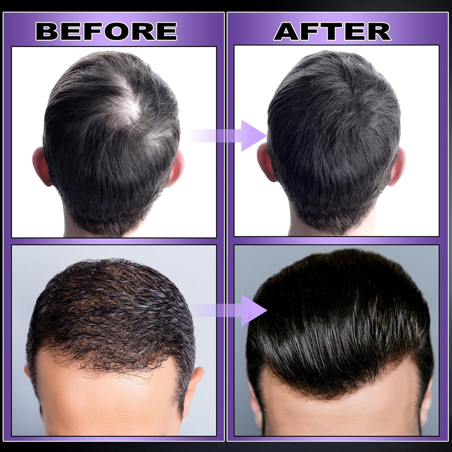 GIFBEA Organic Black Rice Water Hair Growth Serum Spray, 5 Fl Oz, Rosemary Scent, For All Hair Types, With Biotin, Castor Oil, Caffeine, Hair Loss Treatment