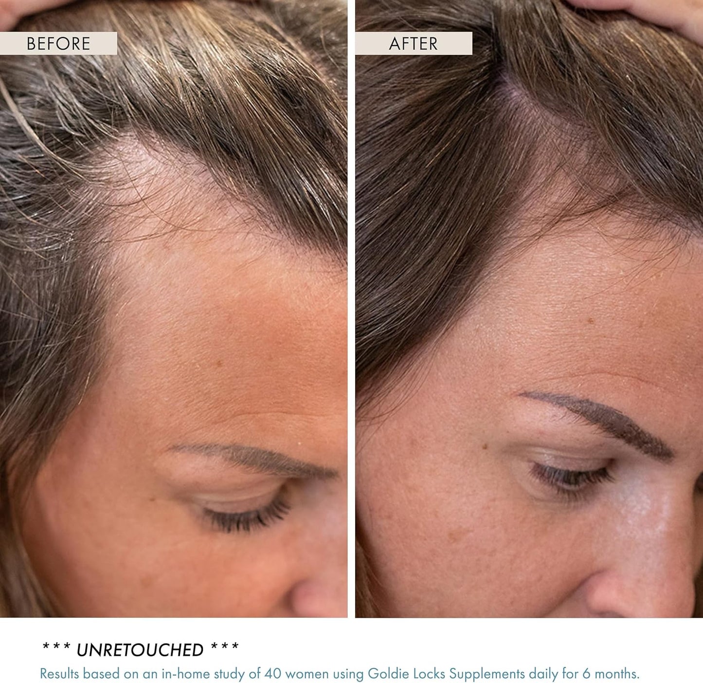 Goldie Locks Hair Growth Supplements Original Formula - Promotes Stronger & Healthier Hair - Vitamins That Enhance Hair, Skin, and Nails, 120 Count